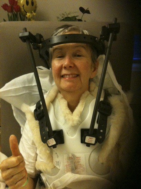 Highline Community College ESL instructor Linda Louie wears a Halo brace to recover from a neck injury.