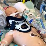 Arista Holland is in intensive care at Harborview Medical Center in Seattle after suffering injuries in a car crash that killed her mother Saturday night along Interstate 5 near Kent. COURTESY PHOTO, GoFundMe.com