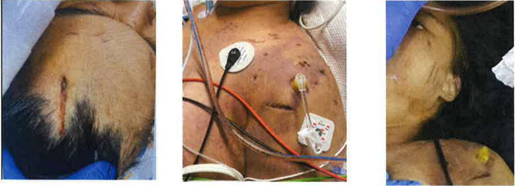 The victim. (Photo from court documents)