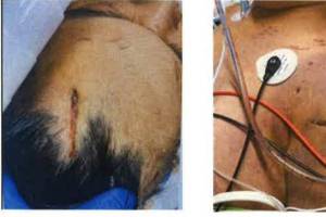 The victim. (Photo from court documents)