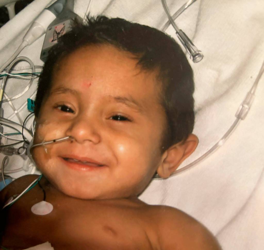 Kaden Hollis as a toddler when he fought a rare liver disease that made if difficult for him to eat, gain weight or stand on his own. COURTESY PHOTO, LifeCenter Northwest