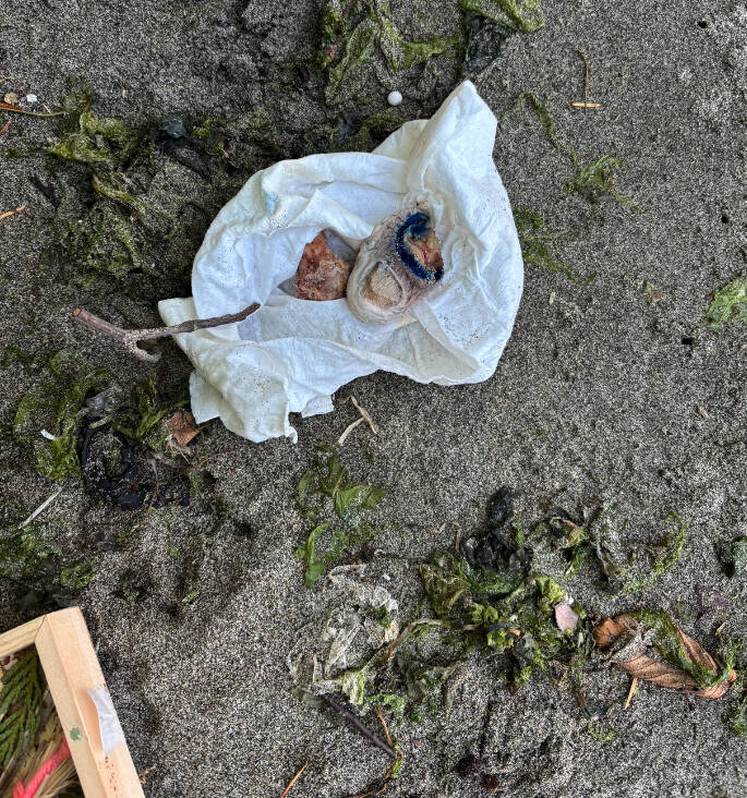 The toe found on the Dash Point State Park beach. From Washington State Patrol records request.